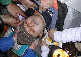 Hypothermia - Signs and Symptoms and Treatment